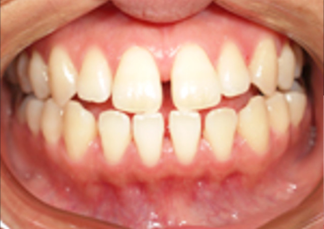 �t���A�[�A�E�g�̓����ɂ���