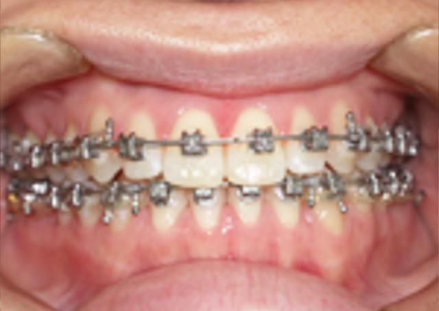 ���Âɂ���