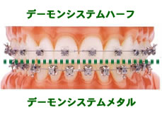 �f�[�����V�X�e���n�[�t�E�f�[�����V�X�e�����^��