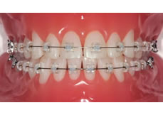 �z���C�g�u���P�b�g