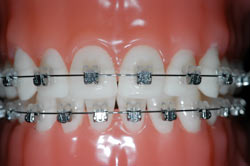 �f�[�����R