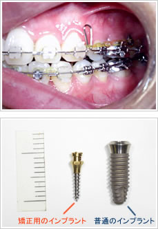 �ɂ��Ȃ��C���v�����g����