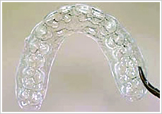 �}�E�X�s�[�X�����N���A�A���C�A�i�[