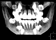 VR�i�{�����[�����^�����O�j