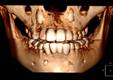 VR�i�{�����[�����^�����O�j